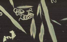 Blågrönalger i närbild Aphanizomenon uppträder normalt i såna här tjocka buntar i Östersjön. Buntarna är,5-1 mm långa och består av mängder av tunna (ca 4 µm breda), enkel-filament av celler.