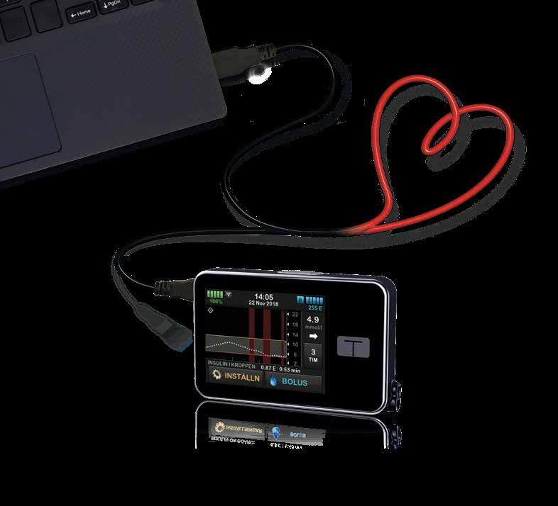 Basal-IQ med Dexcom G6