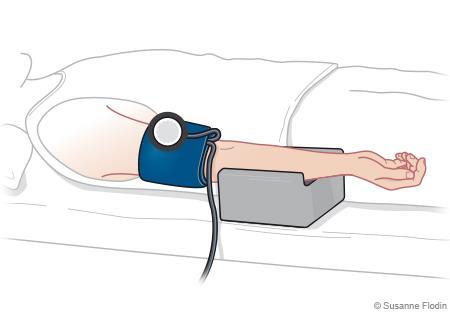 Blodtrycksmätning Armen i rätt nivå Vid liggande blodtrycksmätning ska armen (a. brachialis) komma i hjärthöjd, egentligen höger förmak.