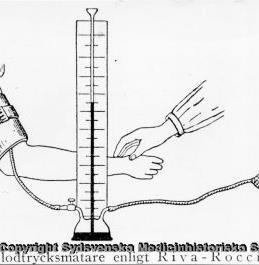 Palpatoriskt Placera blodtrycksmanschetten stadigt men inte för hårt kring överarmen (2 fingrar ska kunna placeras under manschetten). Palpera pulsen i a.radialis eller a.brachialis.