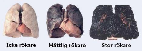 Rökning Socialstyrelsen uppskattar att cirka 12 000 personer avlider på grund av sin rökning varje år. Det innebär att rökningen står för mer än vart tionde dödsfall hos människor i Sverige.