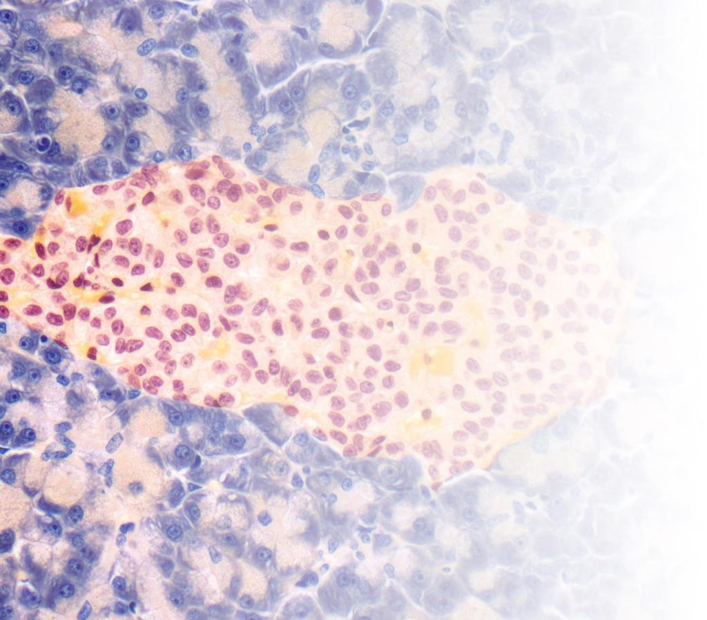 Follicums diabetesprojekt Follicums diabetesprojekt Follicum utvecklar vävnadsreparerande peptider för att skydda de insulin-producerande cellerna, bromsa sjukdoms-förloppet och motverka uppkomsten