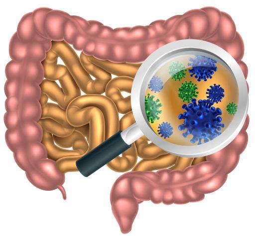 Rätt mat för tarmen stärker immunförsvaret 5 En dålig tarmflora kan leda till att immunsförsvaret blir sämre och att inflammationsgraden ökar.