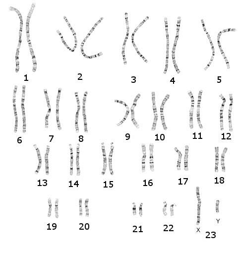 6 Figur 3: Kromosomer efter att ha blivit sorterade: en karyotyp 7 kompetensen hos en molekylärgenetiker.
