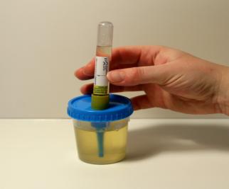 Patientanvisning 1/3 Urinprovtagning Förberedelser inför undersökningen Det mest pålitliga resultatet fås av prov från morgonurinen. Urinens sammansättning påverkas av mat och dryck.