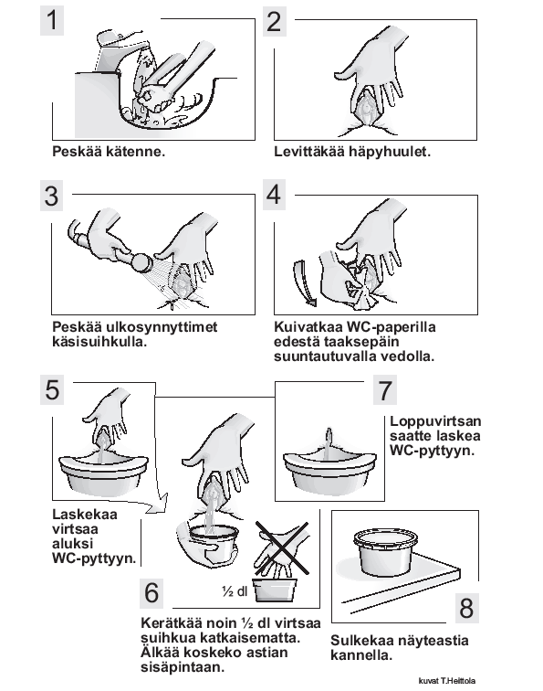 Patientanvisning 2/3 MÄN KVINNOR Tvätta händerna. Dra förhuden bak. Det är nödvändigt för er att TVÄTTA UNDERLIVET OMSORGSFULLT för få ett rent prov! Utför tvätten i första hand med handdusch.