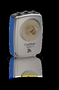 Fler möjligheter utan sladdar Med Cochlears trådlösa teknik kan patienten strömma ljud av hög kvalitet direkt till ljudprocessorn.