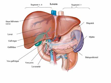 Levertransplantation Organtransplantation innebär att man opererar in ett organ från en givare till en mottagare.