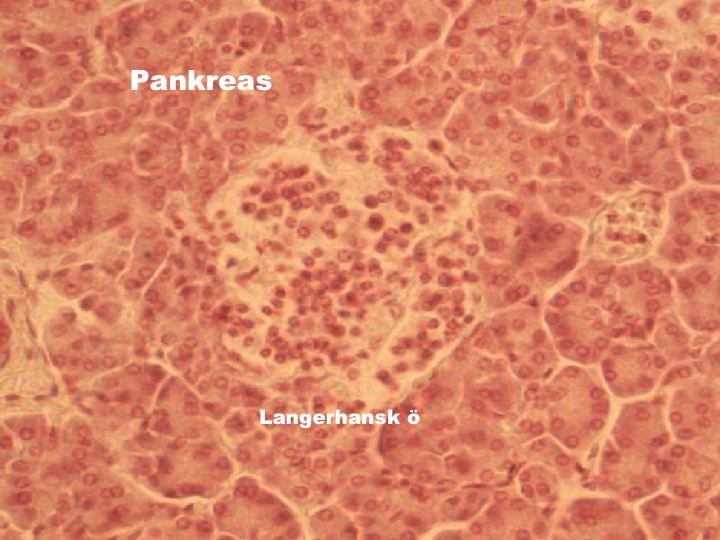 Utspridda i hela pankreas ligger minst en miljon Langerhanska öar. På bilden visas en stor Langerhansk ö och en lite mindre.