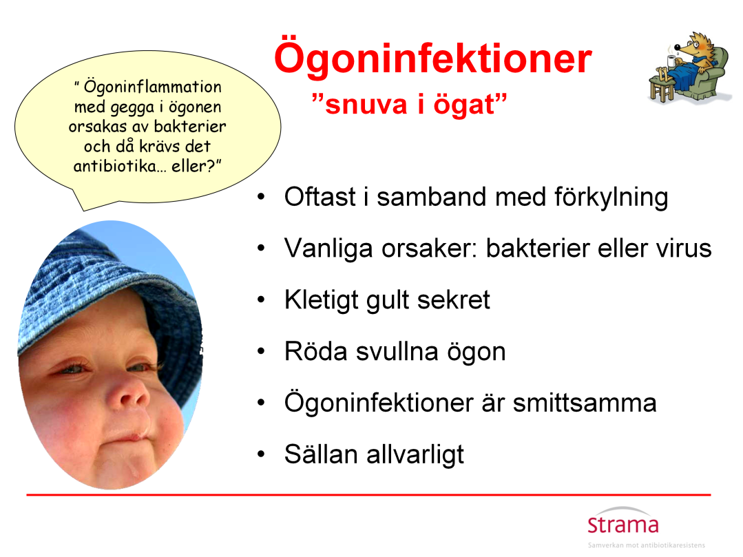 Det är inte helt ovanligt att barn i förskoleåldern får en ögoninfektion (konjunktivit) i samband med förkylning. Infektionen sitter i ögats bindhinna.