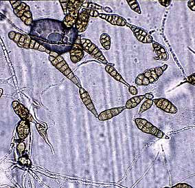 Aspergillus versicolor Penicillium