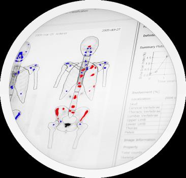 Automated Bone Scan Index Analytical validation study, 2009 When compared to manual methods, the automated reads improve the accuracy, sensitivity, and specificity of detecting metastatic lesion to