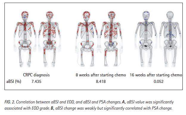 absi som biomarkör för effekt och prognos vid kemoterapi Objective: To value of automated BSI to indicate chemotherapy response and to predict prognosis in patients with CRPC with bone metastasis