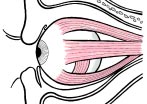 Möbius syndrom De viktigaste kännetecknen vid Möbius syndrom är en medfödd försvagning eller förlamning av ögats utåtförande muskel och av vissa ansiktsmuskler.