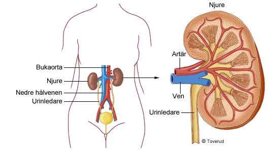 Avhandling Bakgrundsfakta Vad är njurarnas funktion? Njurarna är två decimeterstora organ som sitter på ryggsidan, bakom bukhålan, i närheten av magsäck och lever.