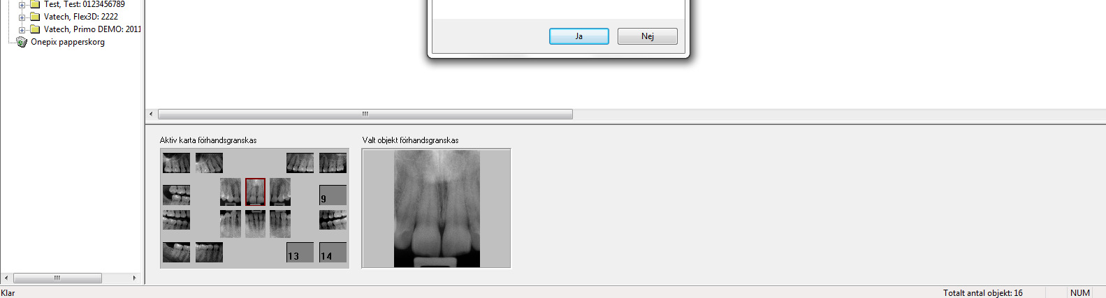 När en patient tas bort, tas alla studier, vyuppsättningar och bilder för patienten bort (de flyttas till papperskorgen i Onepix).