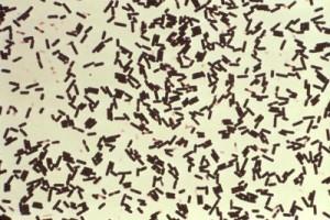 Clostridium Sordelli Fallbeskrivningar 45 fall (1927-2006) Anaerob grampositiv stav Finns i jord, tarm Bildar toxiner (toxic shock syndrome) Utlösande: trauma, förlossning, missfall/ abort, i v