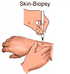 Direct Observation of Procedural Skills (DOPS) Observation av ST-läkare - innan - under -