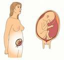 Obstetrik Sjukdomslära, diagnos- och åtgärdskodning.