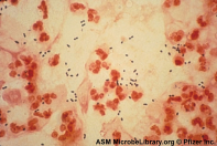 Samhällsförvärvad pneumoni etiologi 30-40 % ingen klar etiologi 10-30(?) % blandinfektioner virus/bakterier 10% enbart virusorsakade Stor variation mellan olika studier!