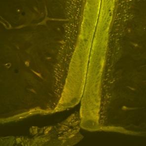 Histologisk normalöversikt, hästens has Morfologiskt kan ledytan delas in i ett brosklager bestående av hyalint brosk och ett subchondralt lager eller subchondralt ben, med ett antal sublager eller