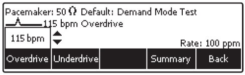 Async (Asynkron pacer-test) Asynkron mode ger en konstant pulsfrekvens när hjärtfrekvensen avviker från det normala.