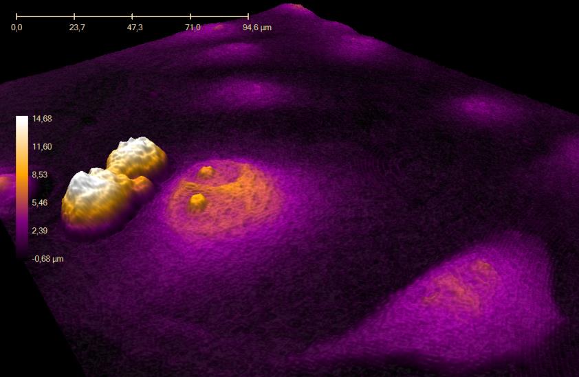 Phase Holographic Imaging PHI AB (PHIAB) utvecklar och säljer ett holografiskt mikroskop i olika modeller för 3D-analys av levande celler.