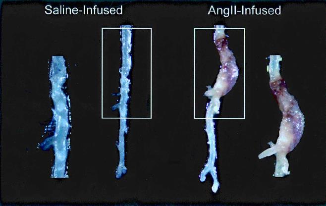 Angiotensin II modellen (AngII) Angiotensin II AngII Lumen