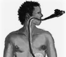 Undersökningar Sjukhistoria. Gastroskopi med biopsi. Röntgen.