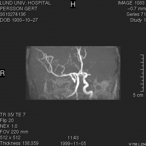 MR-angiografi 3