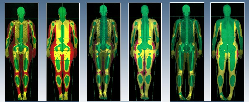 Våra tester BODY SCAN - kroppskompositionstestning med bentäthetsmätning med avancerad röntgenteknologi som ger mycket låg strålning.