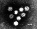 Calicivirus ( Norwalk ) Plötsligt insättande kaskadkräkningar, ofta utan föregående