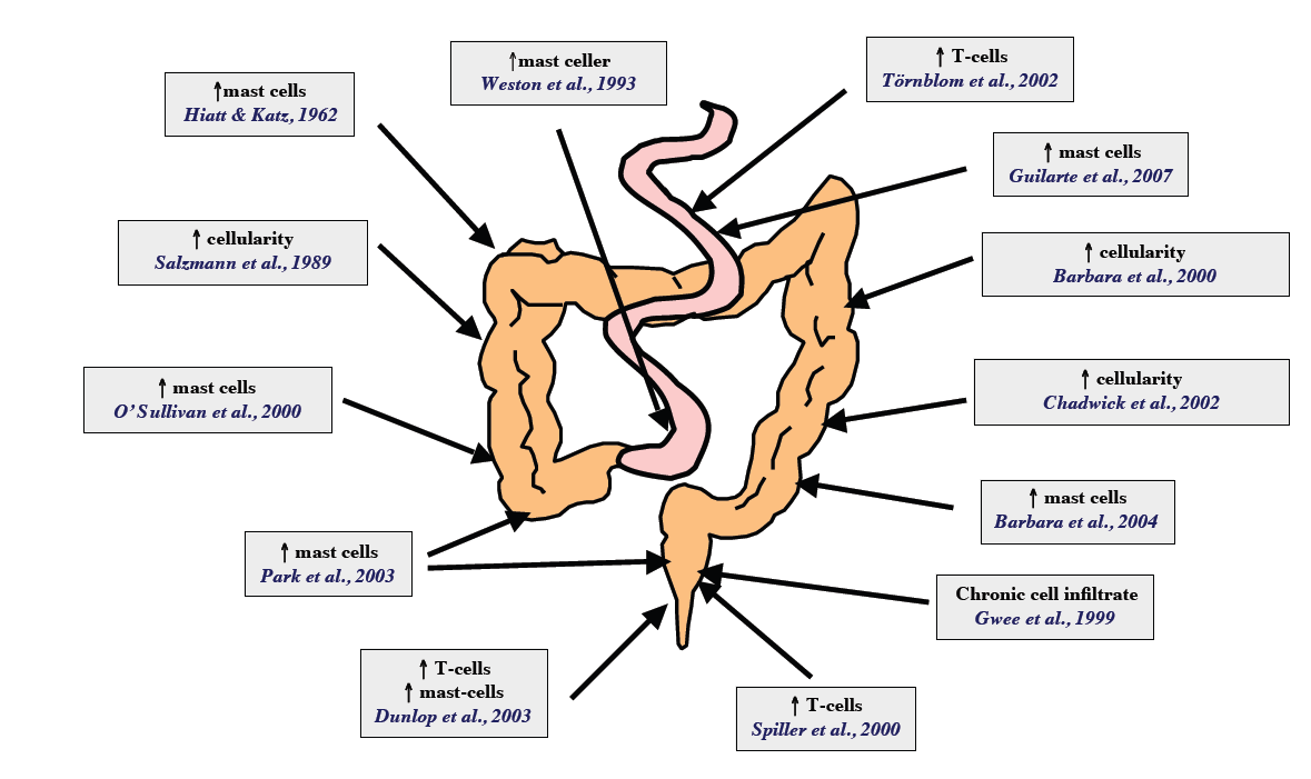 IBS