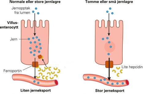 Då hepcidin binder till ferroportin internaliseras det och degraderas Produktionen av hepcidin i levern regleras