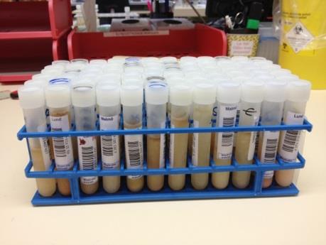 66 Urine Samples Benzodiazepines Lab 1 29 Positive 37