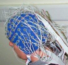 signaler EEG Avbildning MRI EEG Electro-encephalograph Elektroder