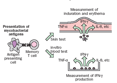 Laboratory tests for TB-reactivity ESAT-6