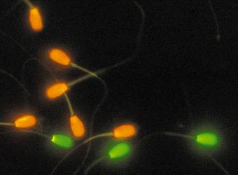 Sperm chromatin structure assay (SCSA ) Red fluorescence single