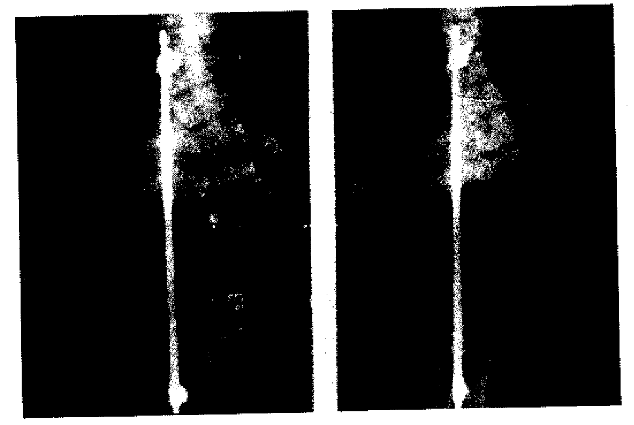 Medicinsk fotogrammetri används på t.ex.
