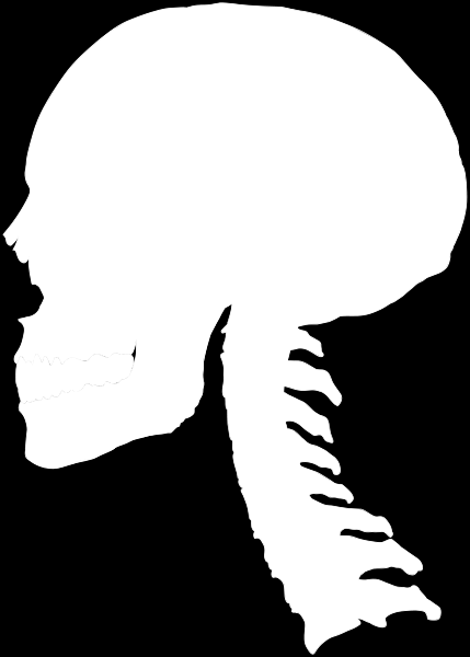 Traumatiska