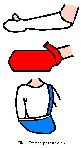 1. BAKGRUND Contraint-induced movement therapy (CI-terapi) står för en repetitiv, intensiv träningsmetod, en så kallad restriktionsinducerad rörelseterapi, vilket innebär att rörelser av den icke