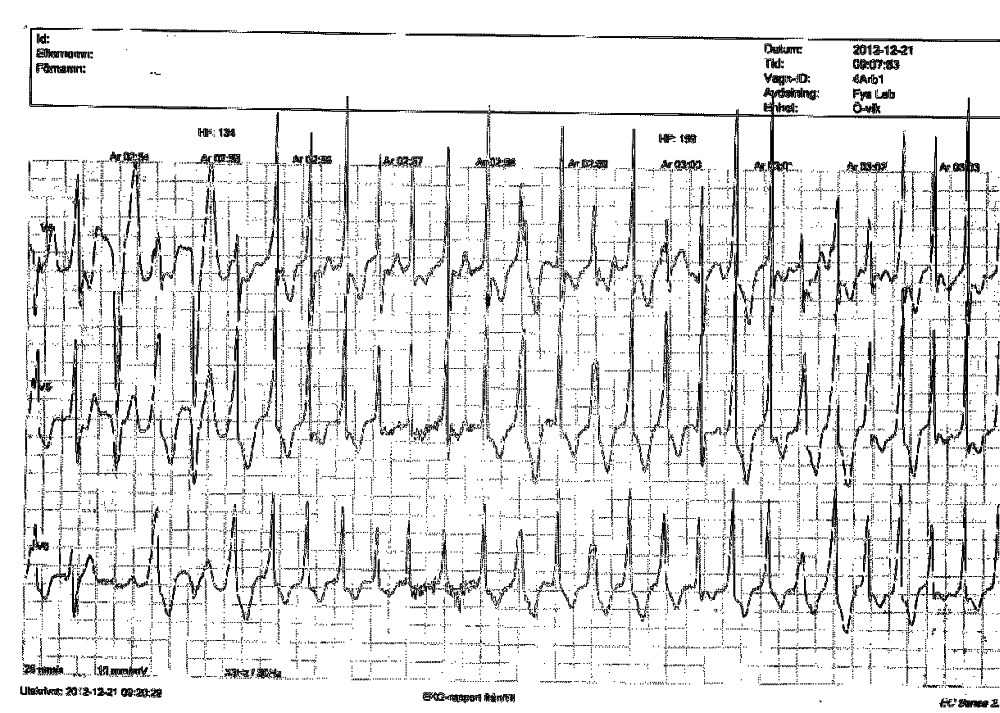 AEKG 95W