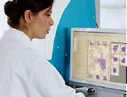 Fördelar med digital mikroskopering Lägre kostnad Högre kvalitet Större patientnytta Automatisering Effektivisering Tidsbesparing Bättre ergonomi Objektiva provsvar Experthjälp