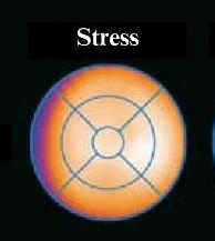 Normal undersökning Stress Rest