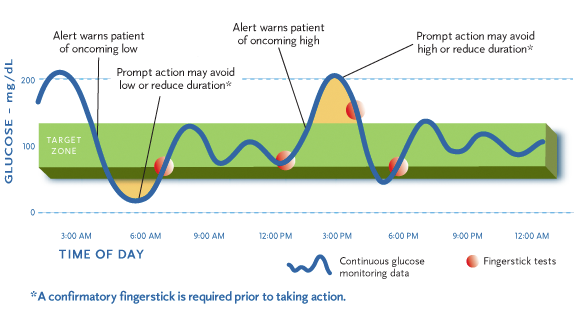 CGM