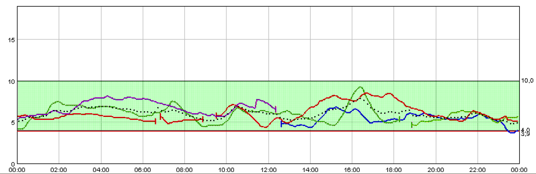CGM