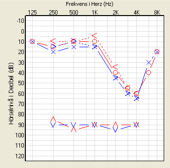 2. Ett mycket viktigt moment när man gör en IF-mätning är att granska och reflektera över sitt resultat. Nedan ser du ett audiogram och en IF-kurva. a. Titta på audiogrammet och IF-kurvan, reflektera och kommentera resultatet, utgå från talets nivå.