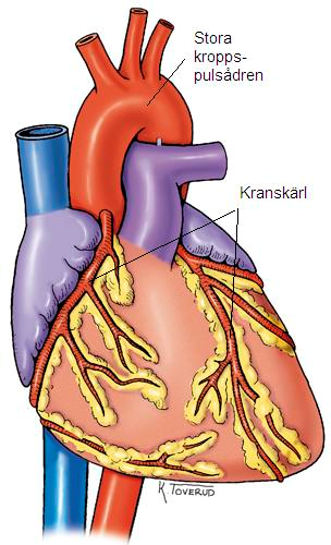 Hjärtats blodförsörjning Hjärtmuskeln har en egen blodförsörjning från två kranskärl Dessa kommer direkt från