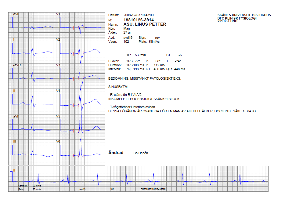 Vilo EKG