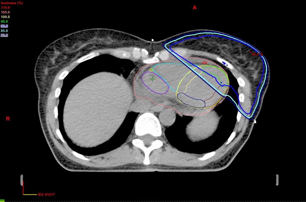 Radiation Oncologist, CTSU